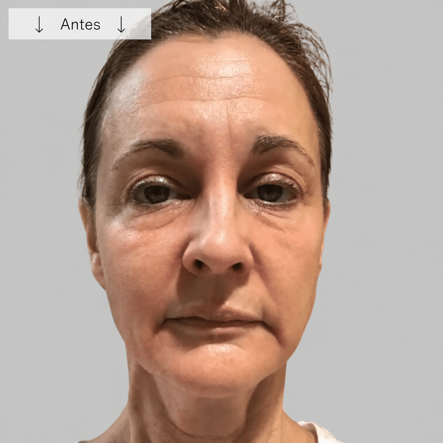 Antes do uso do FaceMassager